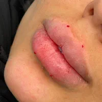 تزریق ژل بوتاکس تاتو پیرسینگ مژه و ...|خدمات آرایشگری و زیبایی|اهواز, پردیس|دیوار