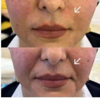 ژل لب شیدینگ تتو مژه کاشت ناخن اف تا اخر ماه|خدمات آرایشگری و زیبایی|اهواز, کمپلو جنوبی|دیوار
