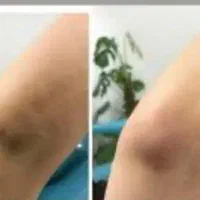 ریمو تتو ابرو،بدن کربن تراپی بادستگاه پیشرفته‌|خدمات آرایشگری و زیبایی|اهواز, کیانپارس |دیوار