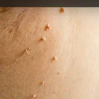 برای همیشه با کاشت ابرو خداحافظی کنید