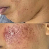 تخفیفات بزرگ رنگ مو کراتین فشیال آموزش ناخن مژه|خدمات آرایشگری و زیبایی|بندرعباس, |دیوار