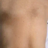 درمان مشکلات پوستی تخصصی|آرایشی، بهداشتی، درمانی|ارومیه, |دیوار