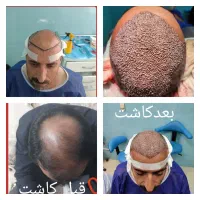 جشنواره یلدایی کاشت موشیرازی از۱۳تومن|خدمات آرایشگری و زیبایی|تهران, صد دستگاه|دیوار