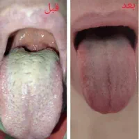دعوت خانم ها به آموزش رایگان طب سنتی