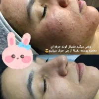 فیشیال و پاکسازی
