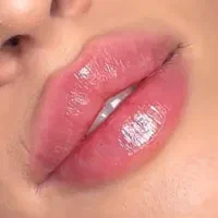 تزریق ژل و بوتاکس ،لیفت صورت با نخ،کاشت نخ