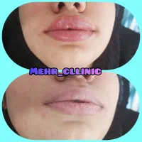 پزشک زیبایی دارای دستگاه لیزر هستم|استخدام درمانی، زیبایی، بهداشتی|اصفهان, دانشگاه اصفهان|دیوار