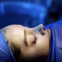 عمل بینی و لیفت صورت نقد و اقساط