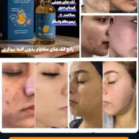 سرم مغذی و ویتامین آ، کرم ضد لک لاکچری کوین|آرایشی، بهداشتی، درمانی|نیشابور, شهرک بسیج|دیوار