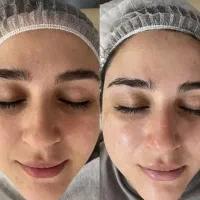 فیشیال تخصصی فقط چهارصد و نود هزار تومان|خدمات آرایشگری و زیبایی|آباده, |دیوار