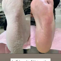 نانو کلوئید نقره رو همه جامعه همراهت داشته باش|مواد شوینده و دستمال کاغذی|یزد, |دیوار