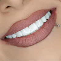 انجام تمامی خدمات دندانپزشکی بااعطا وام