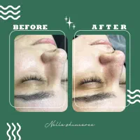 فیشال و پاکسازی پوست|خدمات آرایشگری و زیبایی|اهواز, سپیدار|دیوار