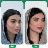 نیازمند مدل جهت خدمات زیبایی