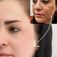 کرم سفیدکننده قوی