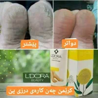 کرم ترک پای قوی لدورا ترمیم سریع ترک و خشکی|آرایشی، بهداشتی، درمانی|شاهرود, |دیوار