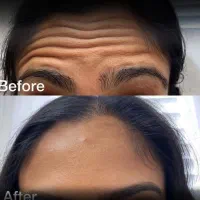 اقساطی/کاشت مو تضمینی/کاشت ابرو/ژل لب|خدمات آرایشگری و زیبایی|سنندج, |دیوار