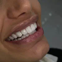 استخدام منشی دندانپزشک