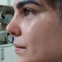 جشنواره رینو پلاستی اتو پلاستی