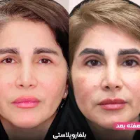 لیپو/ابدو/بلفارو/کاشت/ قسطی در تهران|خدمات آرایشگری و زیبایی|زاهدان, |دیوار