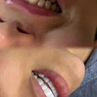 کلینیک دندان پزشکی،کاشت ابرو،ژل|خدمات زیبایی و سلامت|اهواز, کوی ملی راه|دیوار