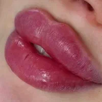 تزریق ژل وجوانسازی تخصصی ومزو ژل،بوتاکس|خدمات آرایشگری و زیبایی|شاهین‌شهر, فردوسی|دیوار