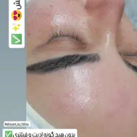 خدمات تخصصی پاکسازی فیشال صورت و بدن با دستگاه|خدمات آرایشگری و زیبایی|شاهین‌شهر, عطار|دیوار