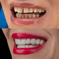 مژده به اهالی محترم گلباف در مورد دندانپزشکی|خدمات آرایشگری و زیبایی|گلباف, |دیوار