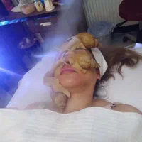 حلزون طبی آلبینو و تخم حلزون|خزنده|مشهد, هنرستان|دیوار