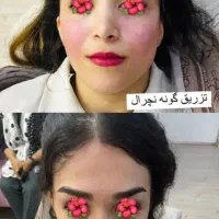 تزریق و آموزش خدمات ژل و بوتاکس و کراتین مو|خدمات آرایشگری و زیبایی|هشتگرد, شهرک اداری|دیوار