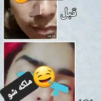 کرم ضدلک تریاک اگوستا|آرایشی، بهداشتی، درمانی|نیشابور, پاستور|دیوار