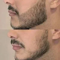 زیر ۳۰ روز ریشو. موهاتو درار