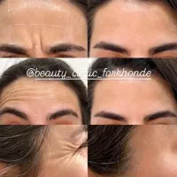 جشنواره ویژه فیلر لب فول فیس زاویه فک،گونه،چونه و.|خدمات آرایشگری و زیبایی|مشهد, شهید فرامرز عباسی|دیوار