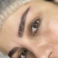 فیبروز و میکروپیگمنتیشن رایگان