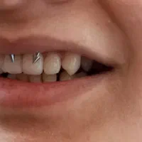 انجام انواع خدمات پیرسینگ