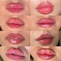 آموزش (تزریقات زیبایی)