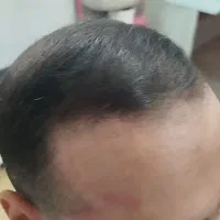 پودر جذاب حجم دهنده و حالت دهنده مو|آرایشی، بهداشتی، درمانی|مشهد, نیزه|دیوار