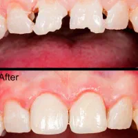 جشنواره یلدایی خدمات دندانپزشکی|خدمات آرایشگری و زیبایی|اردبیل, |دیوار