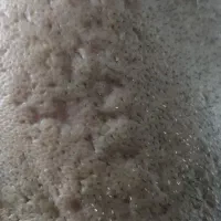 هایفوتراپی و آر اف ۷بعدی اولترا|خدمات آرایشگری و زیبایی|قم, زینبیه|دیوار