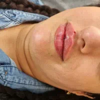 ۵۰٪تخفیف ویژه کلینیک نورا|خدمات آرایشگری و زیبایی|محمدشهر, محمدشهر|دیوار