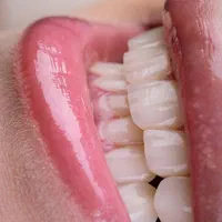 خدمات دندانپزشکی زیبایی