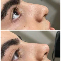 اصلاح فرم|خدمات آرایشگری و زیبایی|سنندج, |دیوار