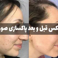 پاکسازی|خدمات آرایشگری و زیبایی|تبریز, |دیوار
