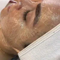 فشیال تخصصی پاکسازی و جوان سازی صورت|خدمات آرایشگری و زیبایی|اصفهان, الهیه|دیوار