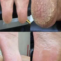 پدیکور درمانی و کاشت ناخن