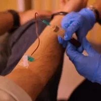 PRP و PRF مطب دکتر مازیار هاشمی