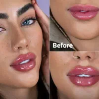 ژل لب روسی بوتاکس مادلینگ تضمینی