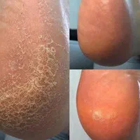 کاشت ناخن مژه دکلره کراتین میکرو بلیدمیکاپ شینیون|خدمات آرایشگری و زیبایی|اندیشه, اندیشه فاز ۱|دیوار