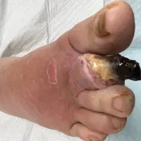 درمان ریشه ای دیابت قطع قرص و انسولین|خدمات آرایشگری و زیبایی|ملایر, |دیوار