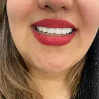 درمانگاه شبانه روزی سیوان فرصت ویژه عصب کشی روکش
